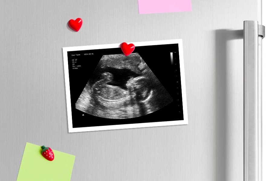 A custom fake sonogram from Baby Maybe on a fridge door