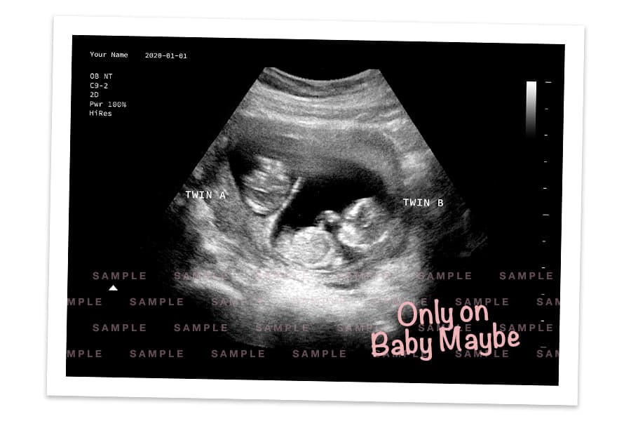 A sample of our fake ultrasounds